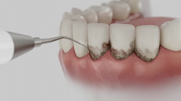 Reliable Dental contractor in Carterville, IL by Dentist Open Now